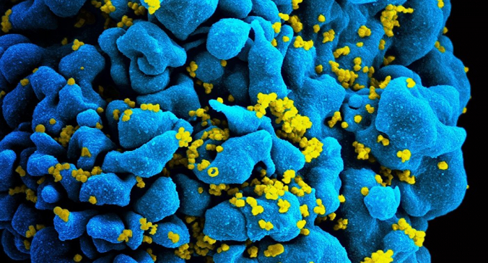  Erstmals seit 20 Jahren:  Neuer HIV-Stamm entdeckt 