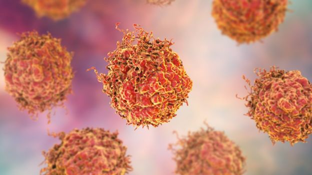 Immunotherapy offers hope for men with prostate cancer