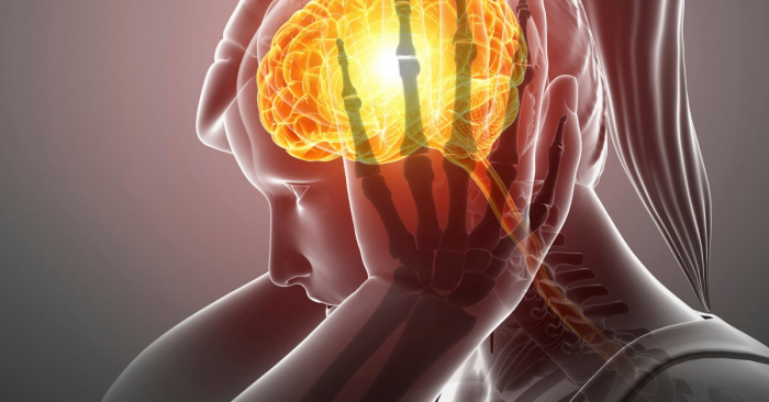 New type of migraine treatment targets pain during an attack