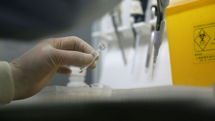 Un nouveau virus identifié en Chine après une pneumonie contractée par 59 patients