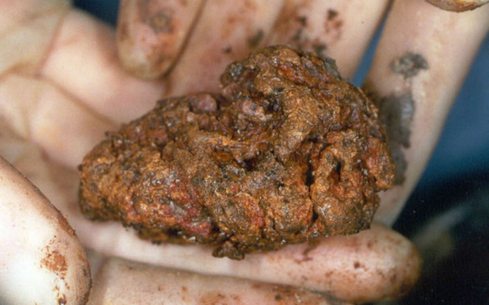  Un morceau de cerveau humain âgé de 2.600 ans est resté presque intact 