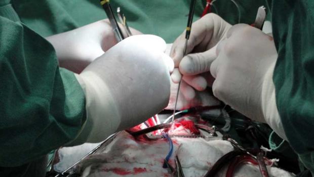   Alemania:   El parlamento rechaza la donación automática de órganos