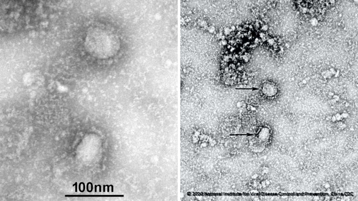   FOTO:   Publican las primeras imágenes del mortal coronavirus originado en China