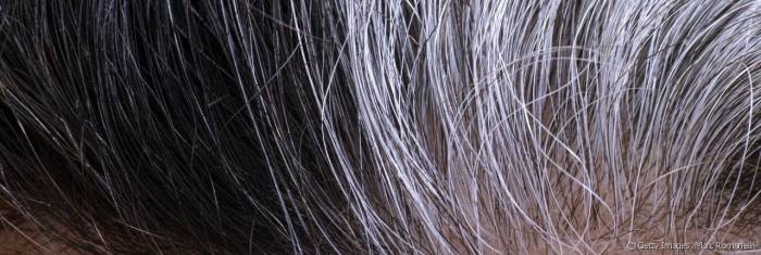 Oui, le stress favorise l’apparition des cheveux gris