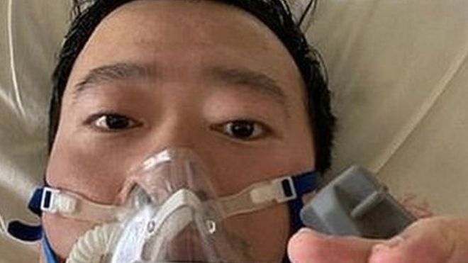 Le méde­cin chinois qui a tenté de donner l’alerte du coro­na­vi­rus serait mort