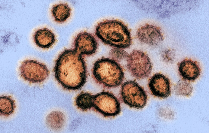 Studie: Coronavirus-Patienten kontaminieren Schlaf- und Waschräume beträchtlich
