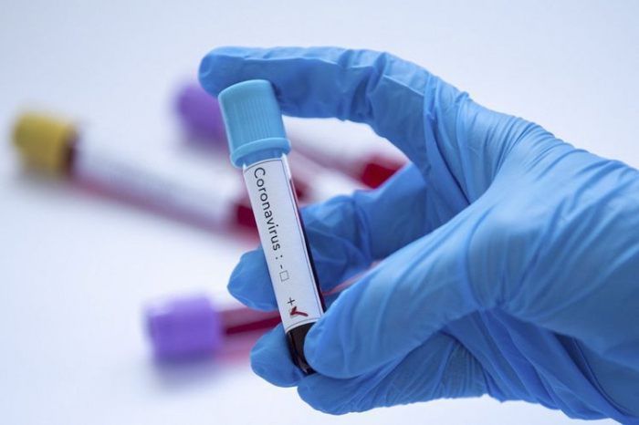 “Koronavirusun vaksini bir ilə hazır olacaq” -  ÜST rəsmisi  