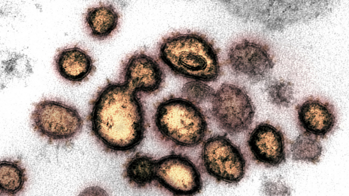 Encuentran en qué etapa el coronavirus puede ser más infeccioso