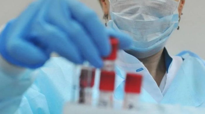   Coronavirus:  29 casos más y un fallecido en Azerbaiyán 