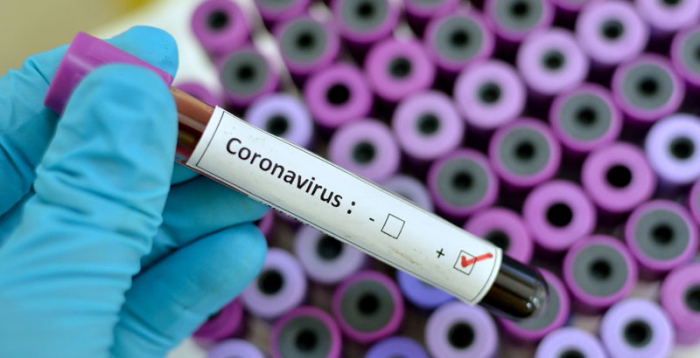  Confirman 43 casos nuevos de coronavirus en Azerbaiyán 