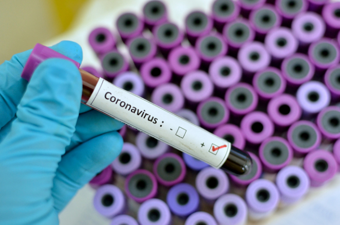 ÜST-nın əməkdaşı İranda koronavirusa yoluxdu