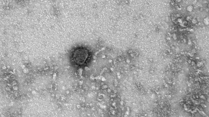  Koronavirusun ilk dəfə şəkilləri yayımlandı 
