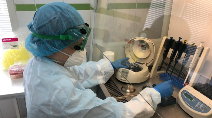 Rusiyada koronavirusu 20 dəqiqəyə aşkarlayan test hazırlandı