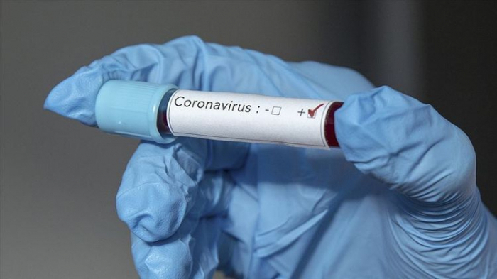 Ölkədə koronavirusa yoluxanların sayı 1480-ə çatdı - RƏSMİ