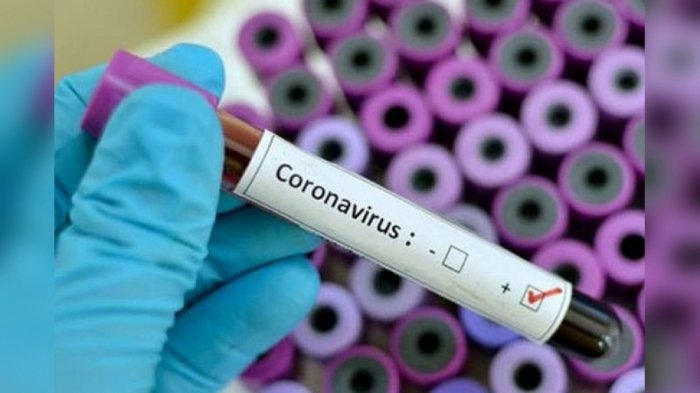 Hindistanda 7447 nəfərdə virus tapıldı