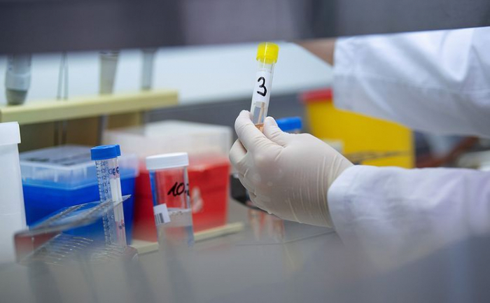  61 more tests positive for coronavirus in Azerbaijan 