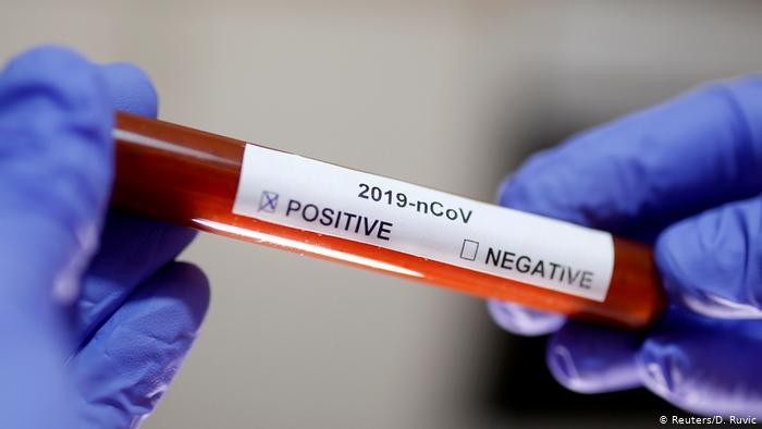   State Committee: Activists of Azerbaijani diaspora infected with coronavirus  