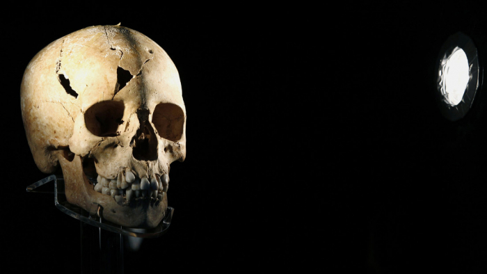 Hallan restos de un guerrero de hace 1.500 años con agujeros en el cráneo "casi perfectos" debido a una cirugía