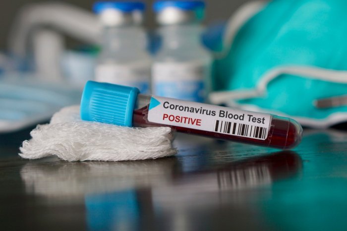 India to buy 75,000 rapid testing kits from South Korea