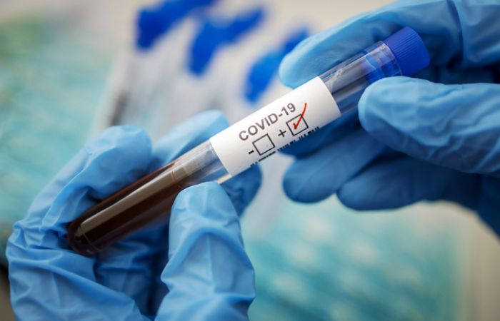  Coronavirus cases pass 3.1 million globally, death toll at over 210,000 
