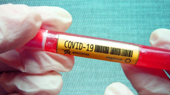 Coronavirus-Infektionsfälle in Italien erstmals gesunken
