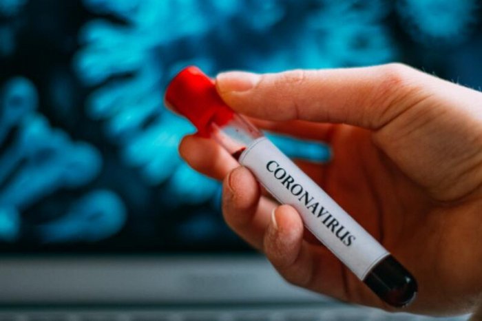 İtaliyada “COVİD-19”dan ölənlərin sayı 22 mini keçib