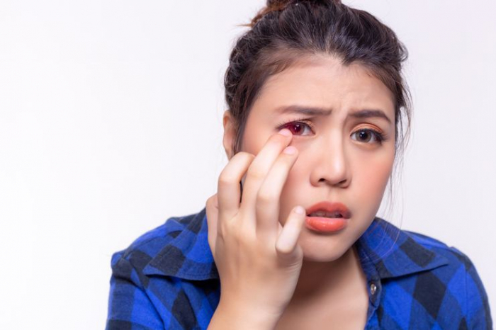  Koronavirus gözlərdə 21 gün özünü gizlədə bilir 