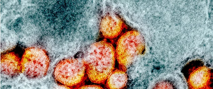 علماء يكشفون مصدر تفشي فيروس "كورونا" في نيويورك