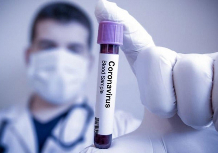    Dünyada koronavirusdan ölənlərin sayı 176 mini keçdi   