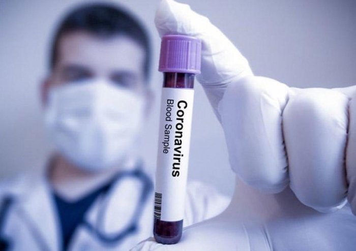 İspaniyada koronavirus qurbanlarının sayı 22 minə yaxınlaşır