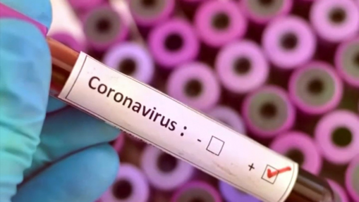 - 18 nəfərdə koronavirus aşkarlanıb