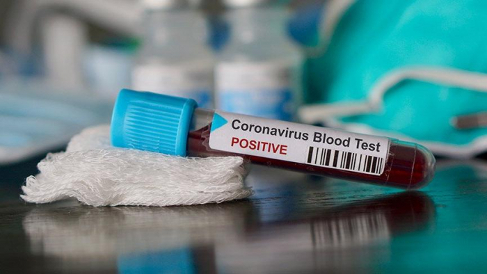Dünyada koronavirusa yoluxanların sayı 1,7 milyonu keçdi
