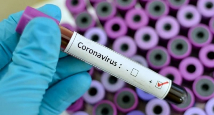  Ermənistanda 20 nəfər koronavirusdan öldü 
