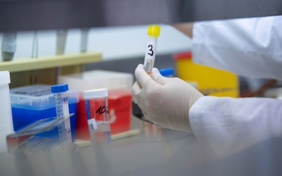     أذربيجان :    تسجيل 67 حالة جديدة للإصابة بفيروس كورونا المستجد وحالة واحدة لوفاة  