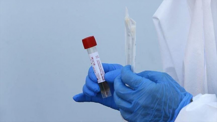   Coronavirus: la Chine autorise les essais cliniques d