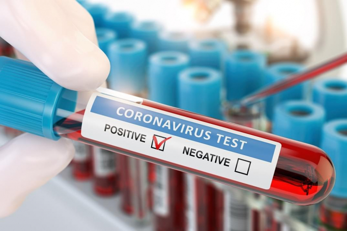  Azərbaycanda daha 118 nəfər koronavirusa yoluxdu, 87-si sağaldı 
