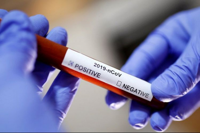    Azərbaycanda daha 67 nəfər koronavirusa yoluxub, 2 nəfər vəfat edib   