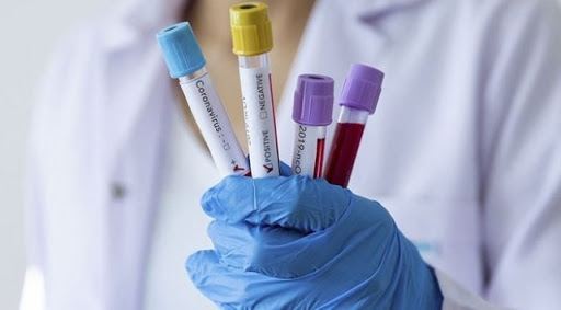   Azerbaijan discloses number of coronavirus tests  