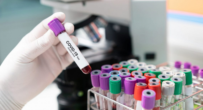  Azerbaijan confirms 113 new coronavirus cases, 40 recovered  