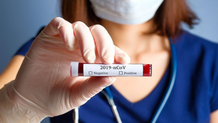  Azərbaycanda daha 2672 nəfər koronavirus testi verdi   