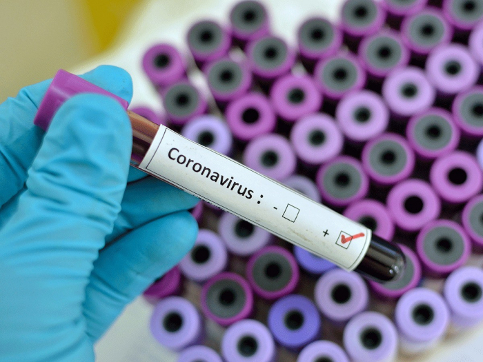 Ölkədə koronavirusdan sağalanların sayı 2198-ə çatdı 