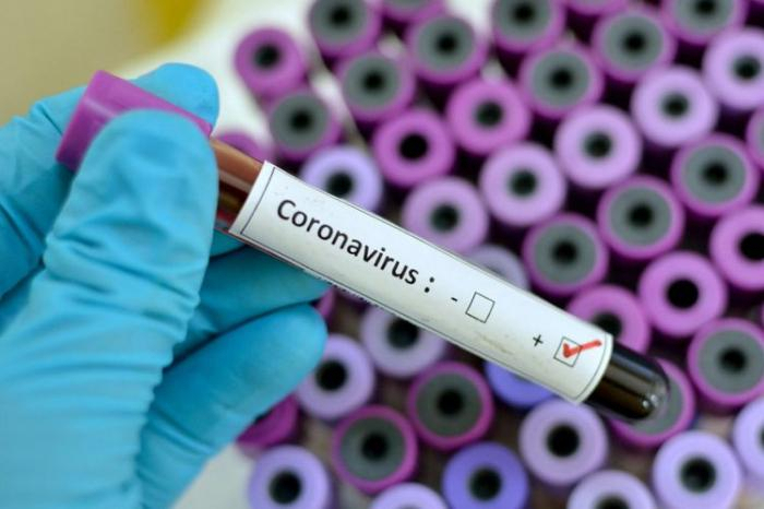   Heute haben 4737 Personen den Coronavirus-Test absolviert  