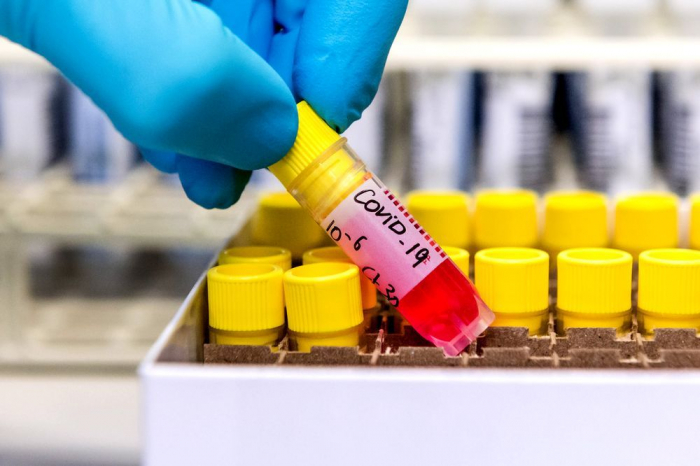  Koronavirusla bağlı testlərin sayı açıqlandı     
