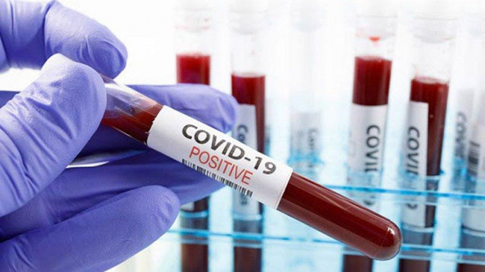Koronavirusa yoluxanların sayı 4,5 milyonu ötdü