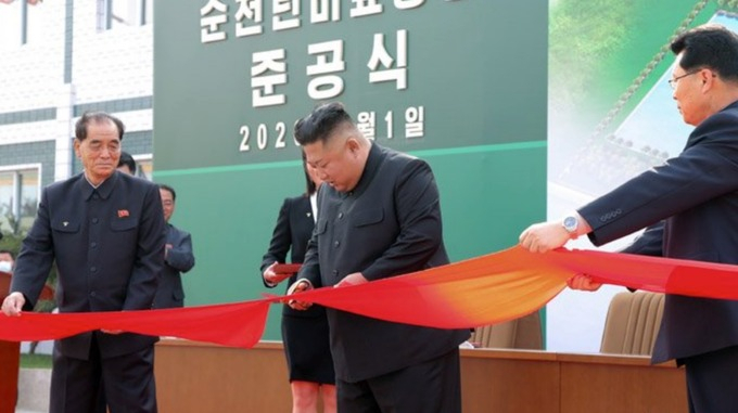  Koreya rəsmisi:  “Kim Çen In əməliyyat olunmayıb”