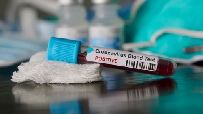“Koronavirusun bəzi nümunələrini məhv etmişik” -  Çindən etiraf  