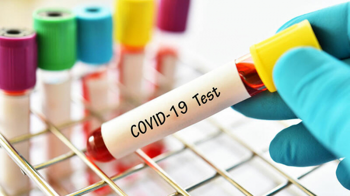    Milli Məclis işçiləri koronavirus testindən keçirilir   