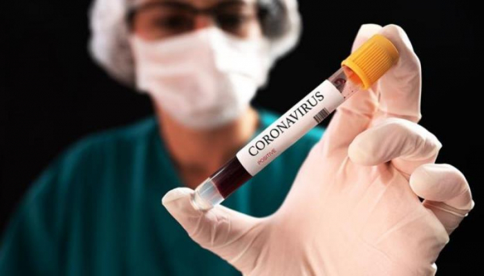    Koronavirusa yoluxanların sayı 5,6 milyonu keçdi    
