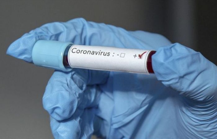   Weitere 65 Menschen mit dem Coronavirus infiziert und 2 starben in Aserbaidschan  