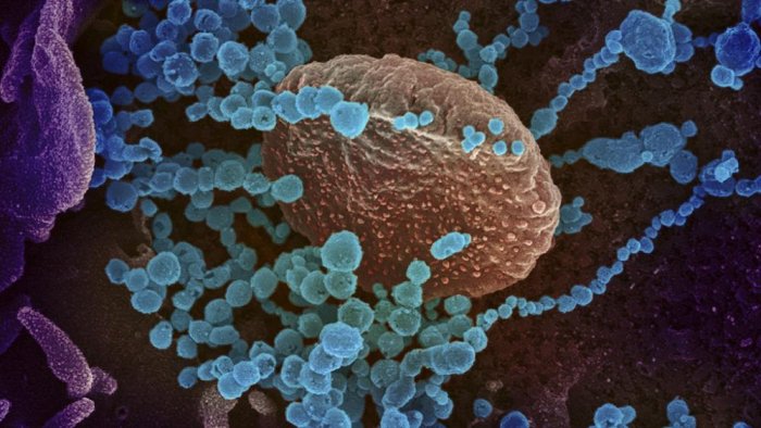 Dans quel cas le nouveau coronavirus pourrait survivre 20 ans